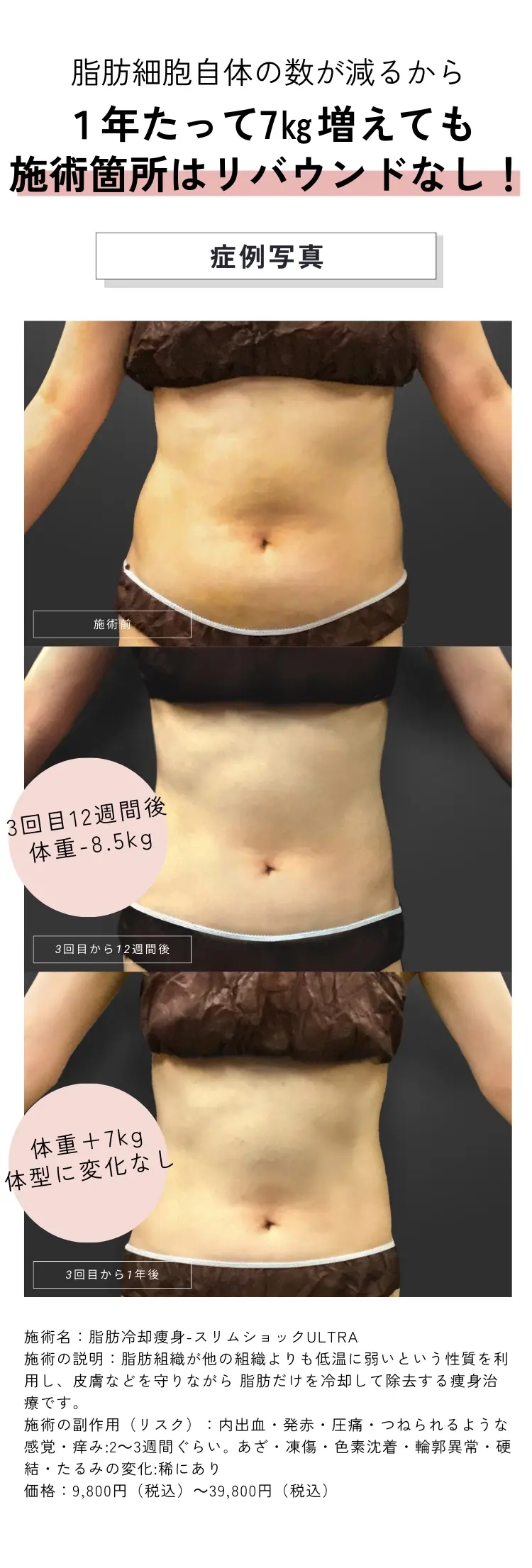 医療脱毛なら誠心美容クリニック