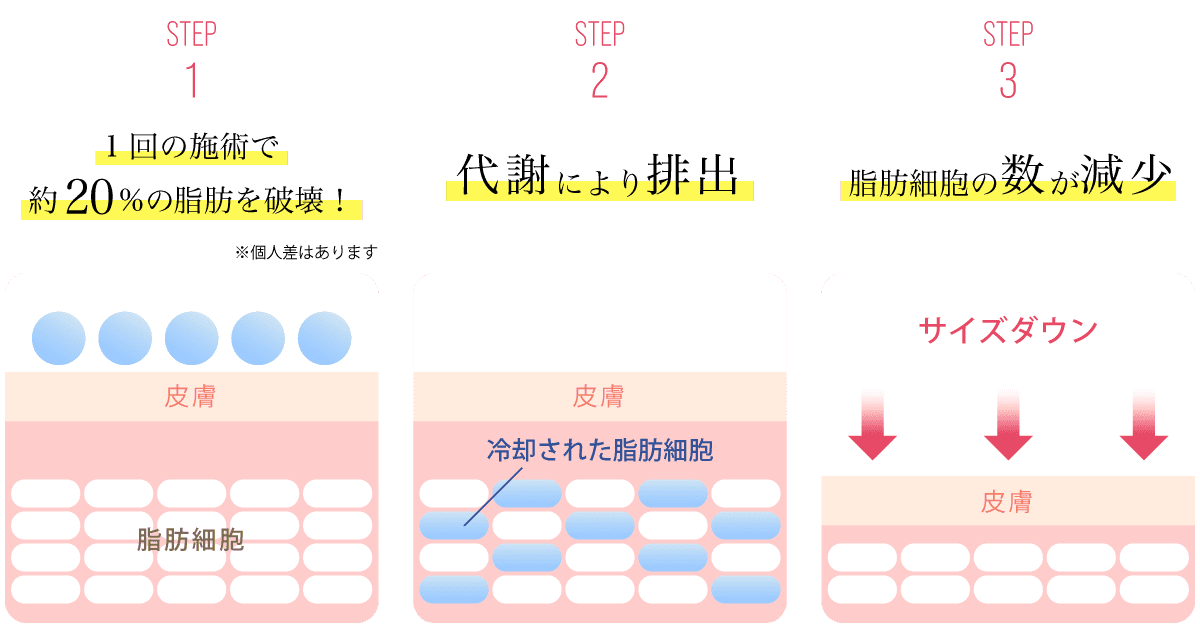 冷凍痩身の仕組み