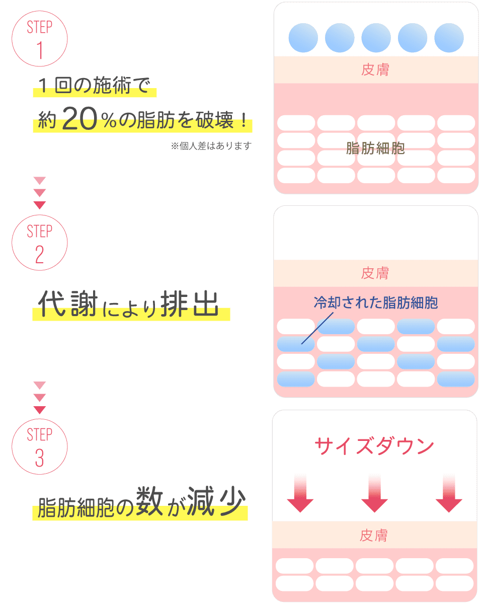 冷凍痩身の仕組み