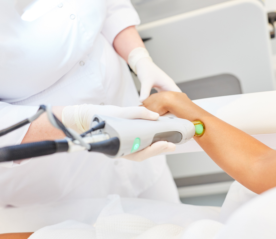 幅広い毛質に対応する医療脱毛